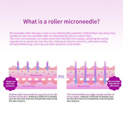 540 Needles Derma Roller 0.75MM - salelink.co.nz