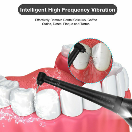 Electric Dental Calculus Remover Tooth Cleaner - salelink.co.nz