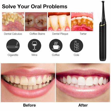 Electric Dental Calculus Remover Tooth Cleaner - salelink.co.nz