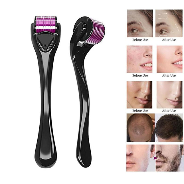 540 Needles Derma Roller 0.75MM - salelink.co.nz